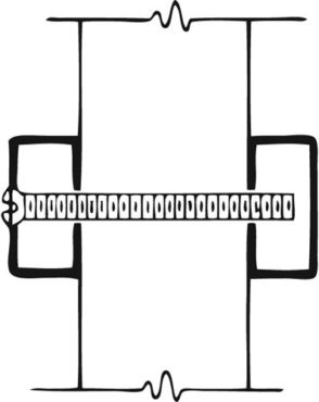 #Type 3 — Thru Bolt Mounting for set of Push/Pull Bars